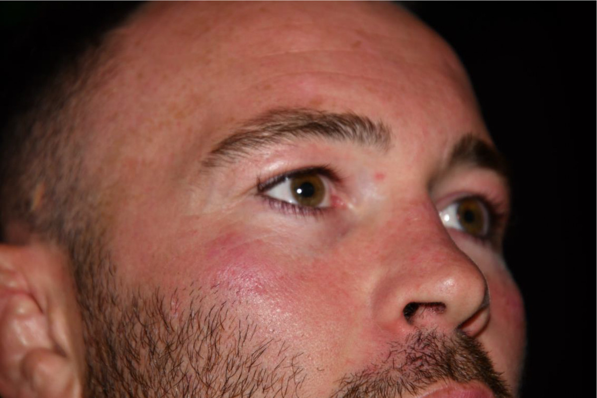 Colby Covington after the alleged assault of Jorge Masvidal